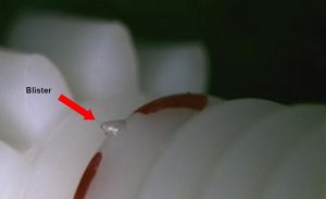 Blister defect in plastic injection molding